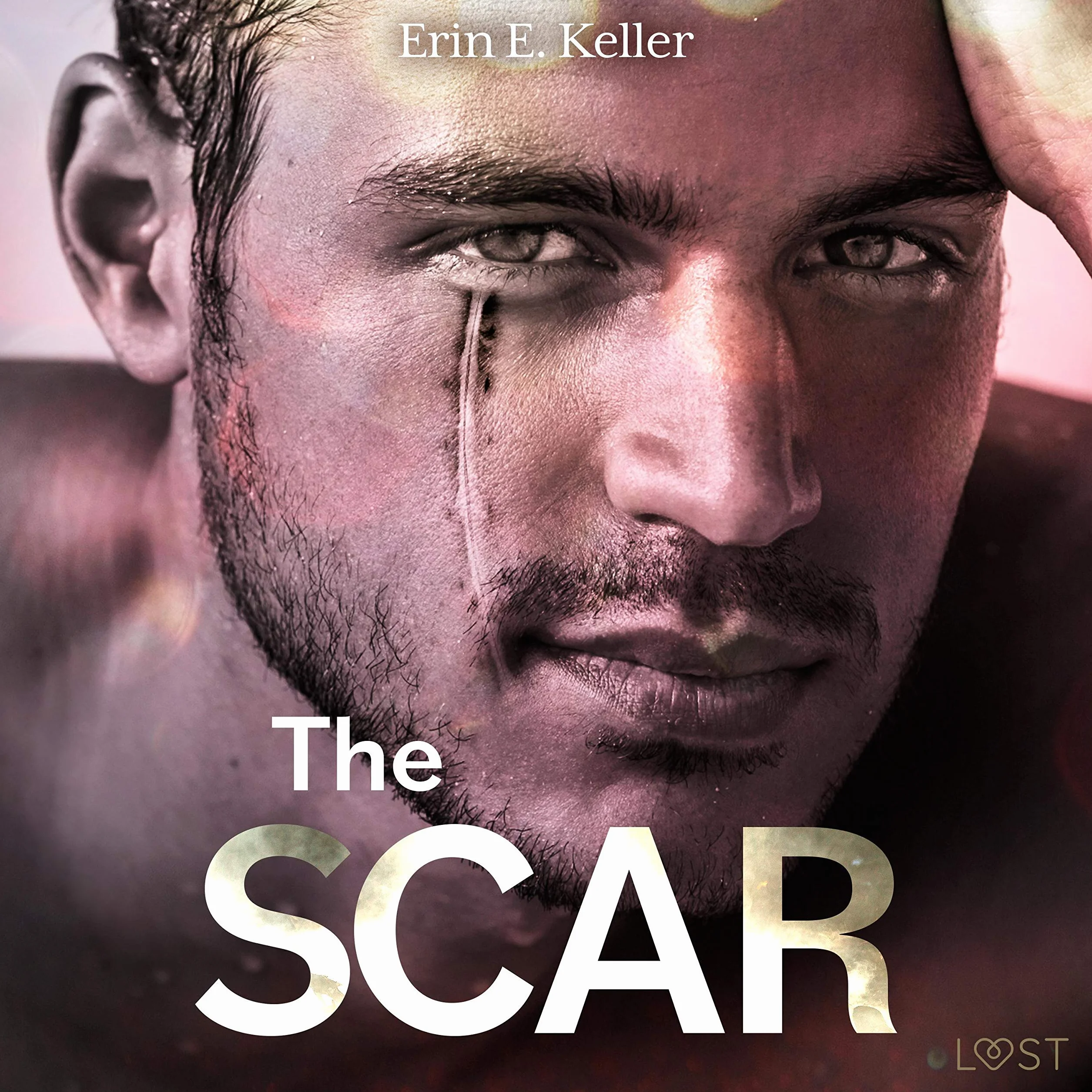 The scar